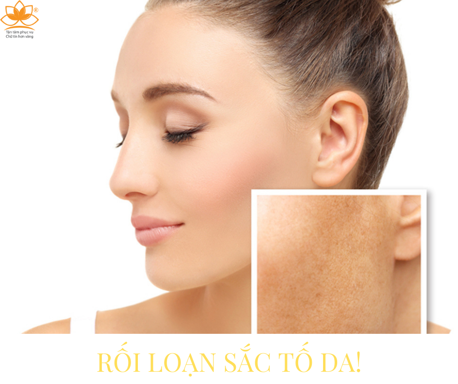 TẠI SAO RỐI LOẠN SẮC TỐ DA???